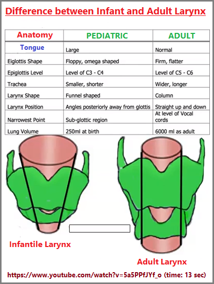 Differences between the Infant and adult larynx (145K)