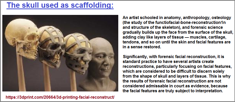 The human skull labeled as scaffolding