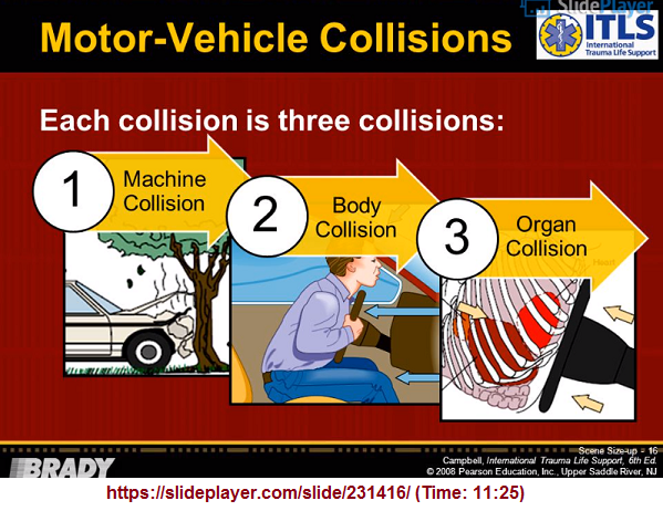 Three types of collision in a veicle crash