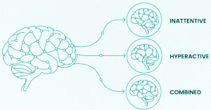 3 Brain types New Brain Study
