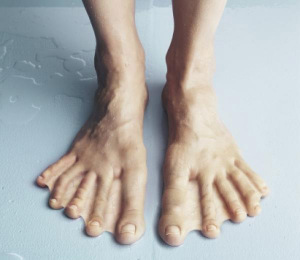 Webbed feet image 1