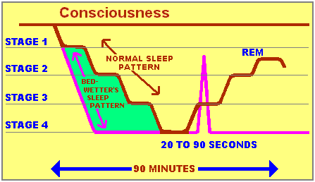 Bedwetter versus normal sleep stages